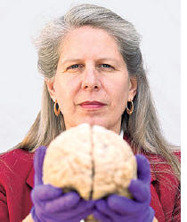 Neurocientista vê seu cérebro se deteriorar 