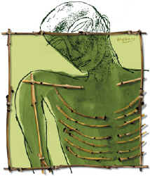 Medicina Paliativa